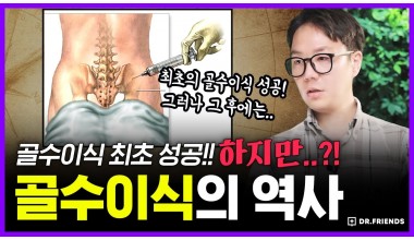 병원에서 골수이식을 받은 환자들이 100% 사망했던 이유 | 의학의 역사 골수 이식 편