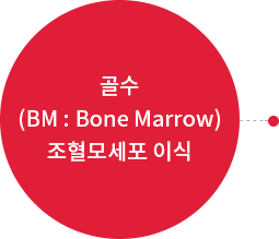 골수(BM:Bone Marrow)조혈모세포 이식